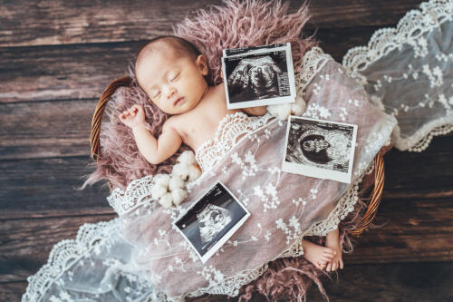 かごの中で眠る赤ちゃんの隣にエコー写真を飾って撮影した新生児写真（撮影：肥後 ほのか）